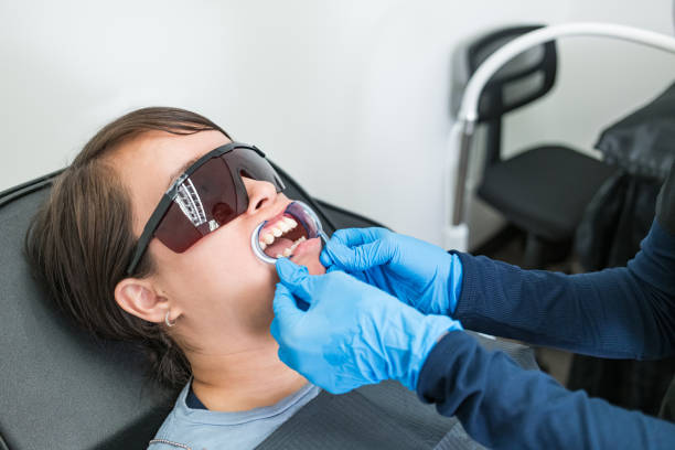 Best Teeth Whitening  in Derby, CO
